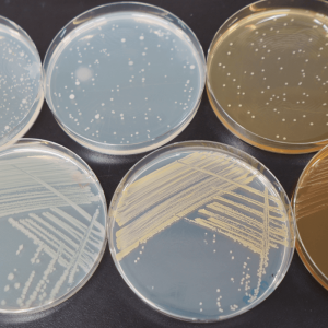 Rapid解析・カビ形態Rapid