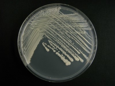 Saccharomyces cerevisiae1