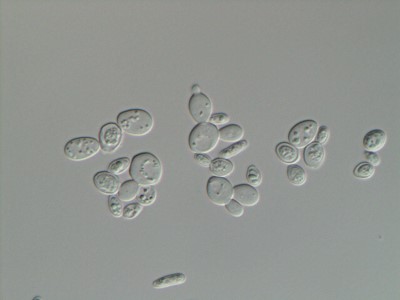 Saccharomyces cerevisiae4