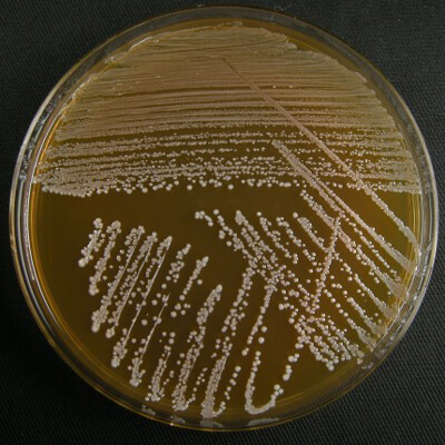 細菌 微生物試験