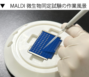 MALDI微生物同定試験(Biotyper)